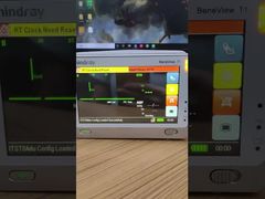 Lihat Mengapa Memilih Layar LCD Monitor Pasien Mindray BeneView T1 Dengan Sampul Depan