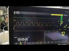 Lihat Modul Mindray AG Modul AG Dan O2 Modul MMS PN 115-023943-00 Demo