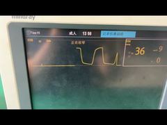 Melihat Lebih Dekat: Perangkap Air Mindray Untuk Modul Gas Anestesi Anak Dewasa 9200-10-10530