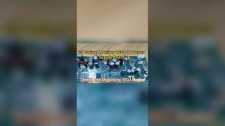 Monitor Pasien Pemantauan Power Supply yang Andal